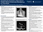Unmasking the Uncommon: A Rare Case of Pediatric Infective Endocarditis Misdiagnosed as a Viral Illness