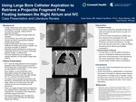 Using Large Bore Catheter Aspiration to Retrieve a Projectile Fragment Free Floating between the Right Atrium and IVC: Case Presentation with Review of Literature