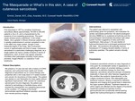 The Masquerade or What's in This Skin; A Case of Cutaneous Sarcoidosis
