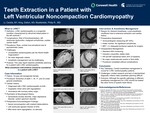 Teeth Extraction in a Patient with Left Ventricular Noncompaction Cardiomyopathy