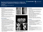 Squamous Cell Carcinoma Arising from a Tailgut Cyst: A Case Report Highlighting the Challenges of Diagnosis and Treatment