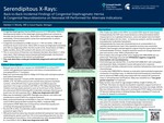 Serendipitous X-Rays: Back-to-Back Incidental Findings of Congenital Diaphragmatic Hernia and Congenital Neuroblastoma on Routine Neonatal XR