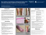 Toxic Erythema of Chemotherapy in Enfortumab Vedotin Limited to the Lower Extremities: Another Form of Pseudocellulitis