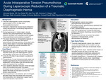 Acute Intraoperative Tension Pneumothorax after Reduction of a Traumatic Diaphragmatic Hernia During Laparoscopic Repair