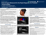 Point-of-Care Ultrasound for the Rapid Diagnosis of a Pulsatile Temporal Mass: A Case of Pseudoaneurysm