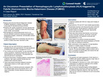 An Uncommon Presentation of Hemophagocytic Lymphohistiocytosis (HLH) triggered by Febrile Ulceronecrotic Mucha-Habermann Disease (FUMHD): A Case Report.