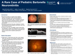 A Rare Case of Pediatric Bartonella Neuroretinitis