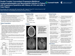 Double Trouble! Concomitant PML and Neurosyphilis Infection in Patient with Progressive Dysarthria with History of CVA and AIDS: A Case Report