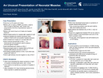 An Unusual Presentation of Neonatal Measles