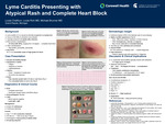 Lyme Carditis Presenting with Atypical Rash and Complete Heart Block