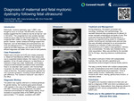 Diagnosis of Maternal and Fetal Myotonic Dystrophy Following Fetal Ultrasound