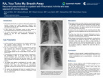 RA, You Take My Breath Away: Recurrent Pneumothorax in a Patient with Rheumatoid Arthritis Who was Weaned off Chronic Steroids
