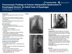 Fluoroscopic Findings of Colonic Interposition Dysfunction in Esophageal Atresia: An Adult Case of Dysphagia