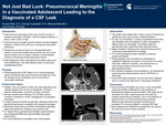 Not Just Bad Luck: Pneumococcal Meningitis in a Vaccinated Adolescent Leading to the Diagnosis of a CSF Leak