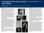 Coarctation of the Aorta Treated with TEVAR