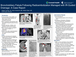Bronchobiliary Fistula Following Radioembolization Managed with IR‑Guided Drainage: A Case Report
