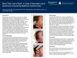 More Than Just a Rash: A Case of Neonatal Lupus Syndrome Uncovering Maternal Autoimmunity