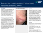 Zosteriform HSV: A Unique Presentation of a Common Disease