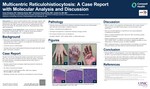 Multicentric Reticulohistiocytosis: A Case Report With Molecular Analysis and Discussion by Casey Schukow, Katherine Burke, Arivarasan Karunmurthy, and Jonhan Ho