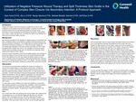 Utilization of Negative Pressure Wound Therapy and Split Thickness Skin Grafts in the Context of Complex Skin Closure Via Secondary Intention: A Protocol Approach by Jihan Toma, Eric Li, Randy Semma, Michele L. Bertelle-Semma, and Asif Khan