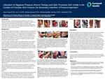Utilization of Negative Pressure Wound Therapy and Split Thickness Skin Grafts in the Context of Complex Skin Closure Via Secondary Intention: A Protocol Approach by Jihan Toma, Eric Li, Randy Semma, Michele Bertelle-Semma, and Asif Khan