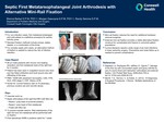 Septic First Metatarsophalangeal Joint Arthrodesis with Alternative Mini-Rail Fixation by Brenna Barker, Morgan Gascoyne, and Randy Semma