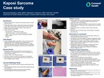 Kaposi Sarcoma Case Study by Mohamed Elshebiny and Marshall G. Solomon
