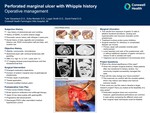 Perforated Marginal Ulcer with Whipple History Operative Management