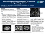 Nephrolithiasis Induced Hydronephrosis as an Unusual Pathology of Biliary Obstruction: A Case Report